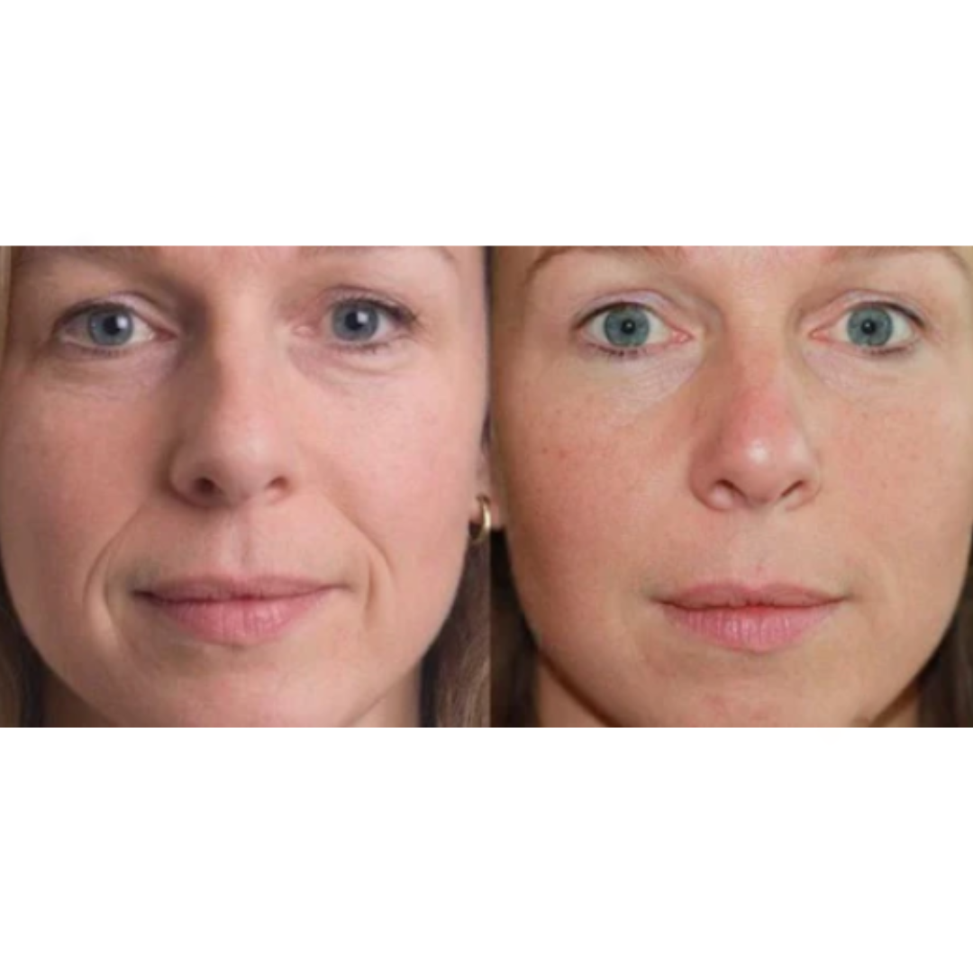 Flexy Beauty – Wiederverwendbare Silikonpflaster
