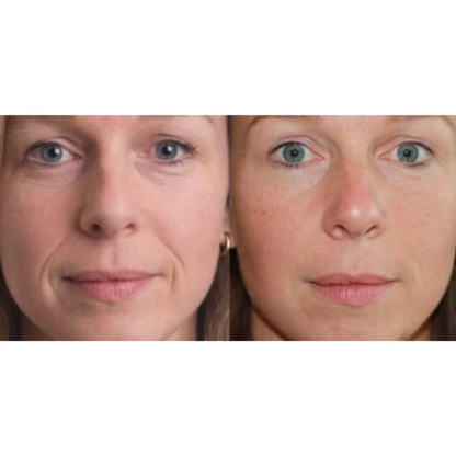 Flexy Beauty – Wiederverwendbare Silikonpflaster