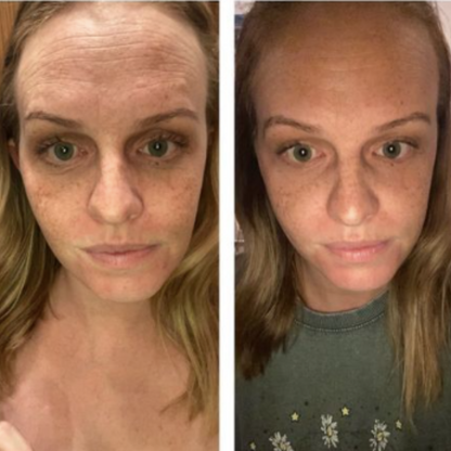 Flexy Beauty – Wiederverwendbare Silikonpflaster